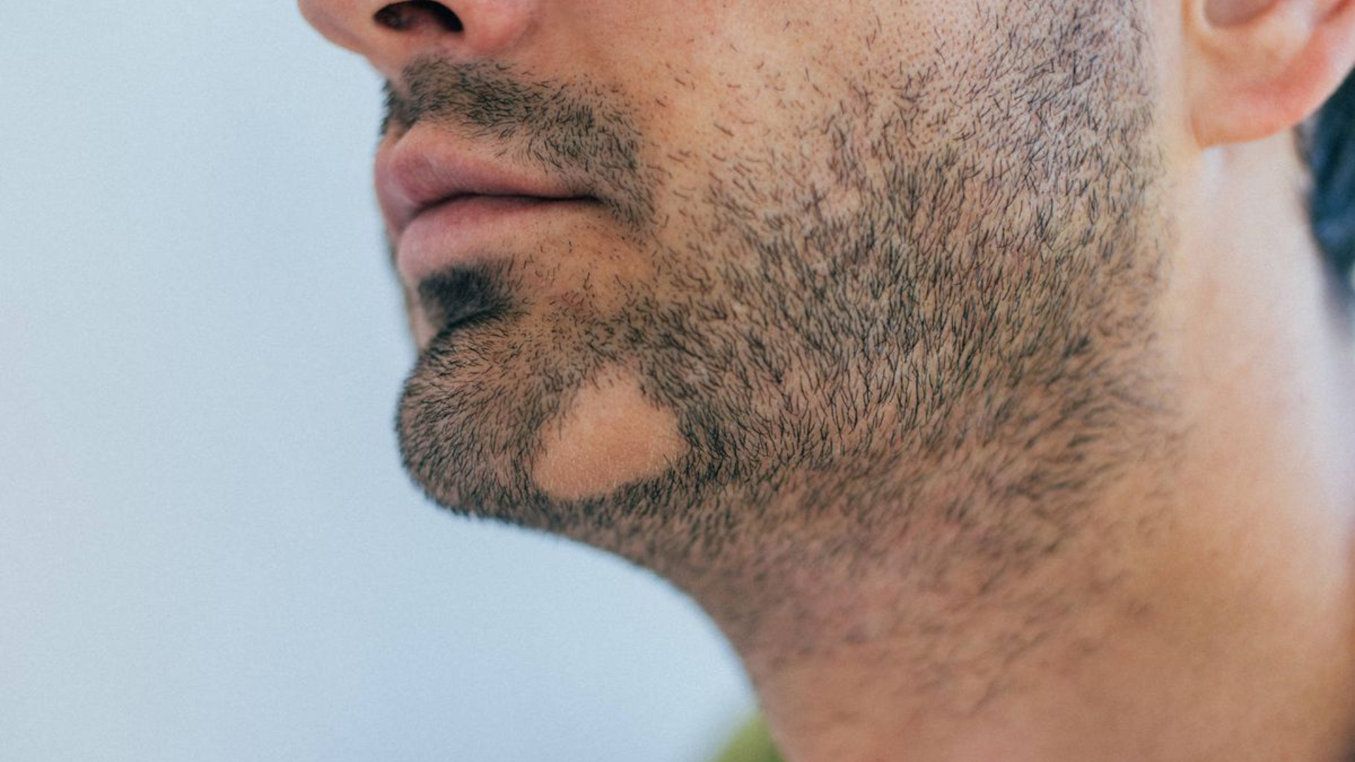 ¿Testosterona baja? La menopausia masculina existe y podría estar afectándote