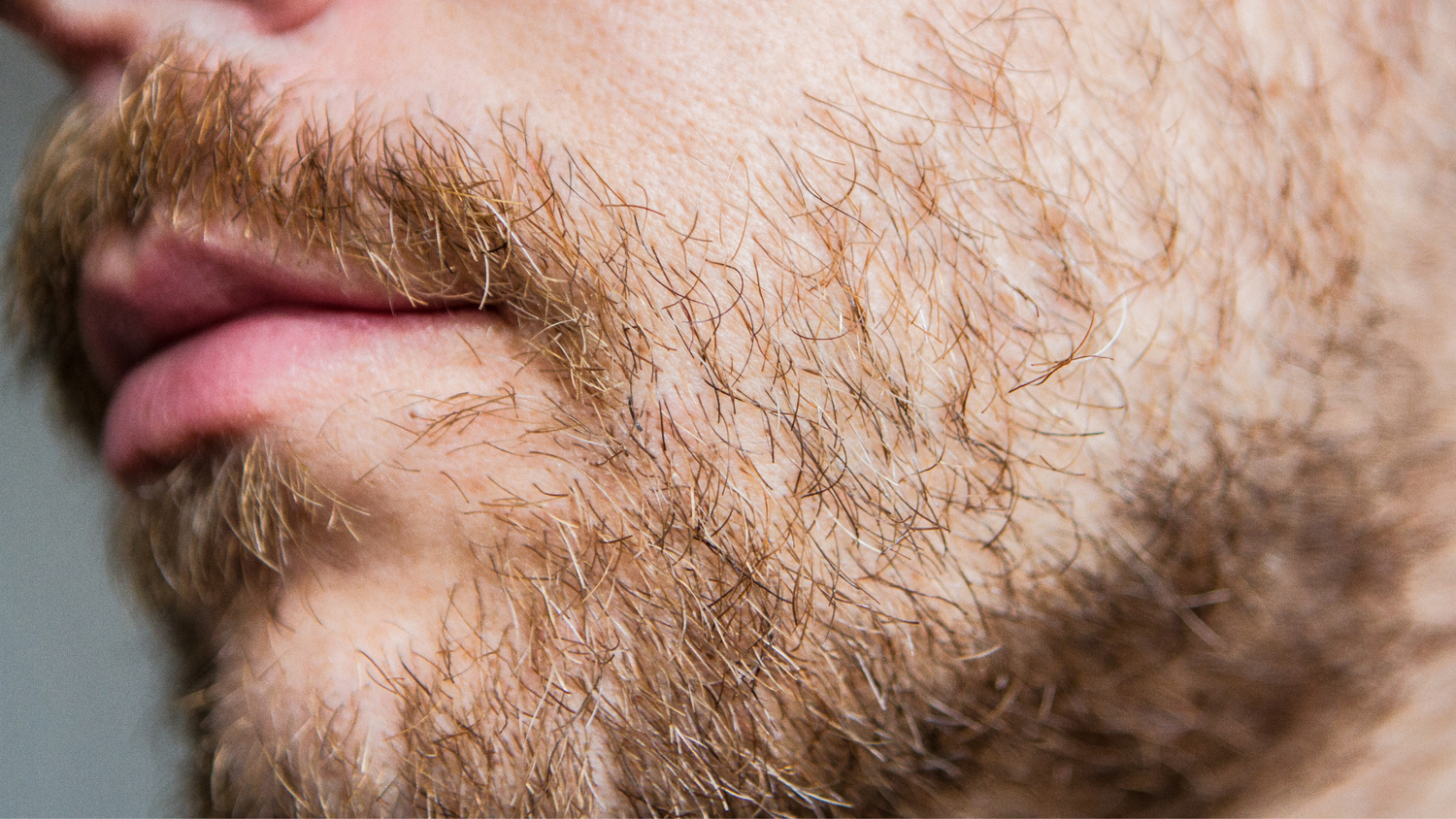 Los efectos de la baja testosterona en la barba