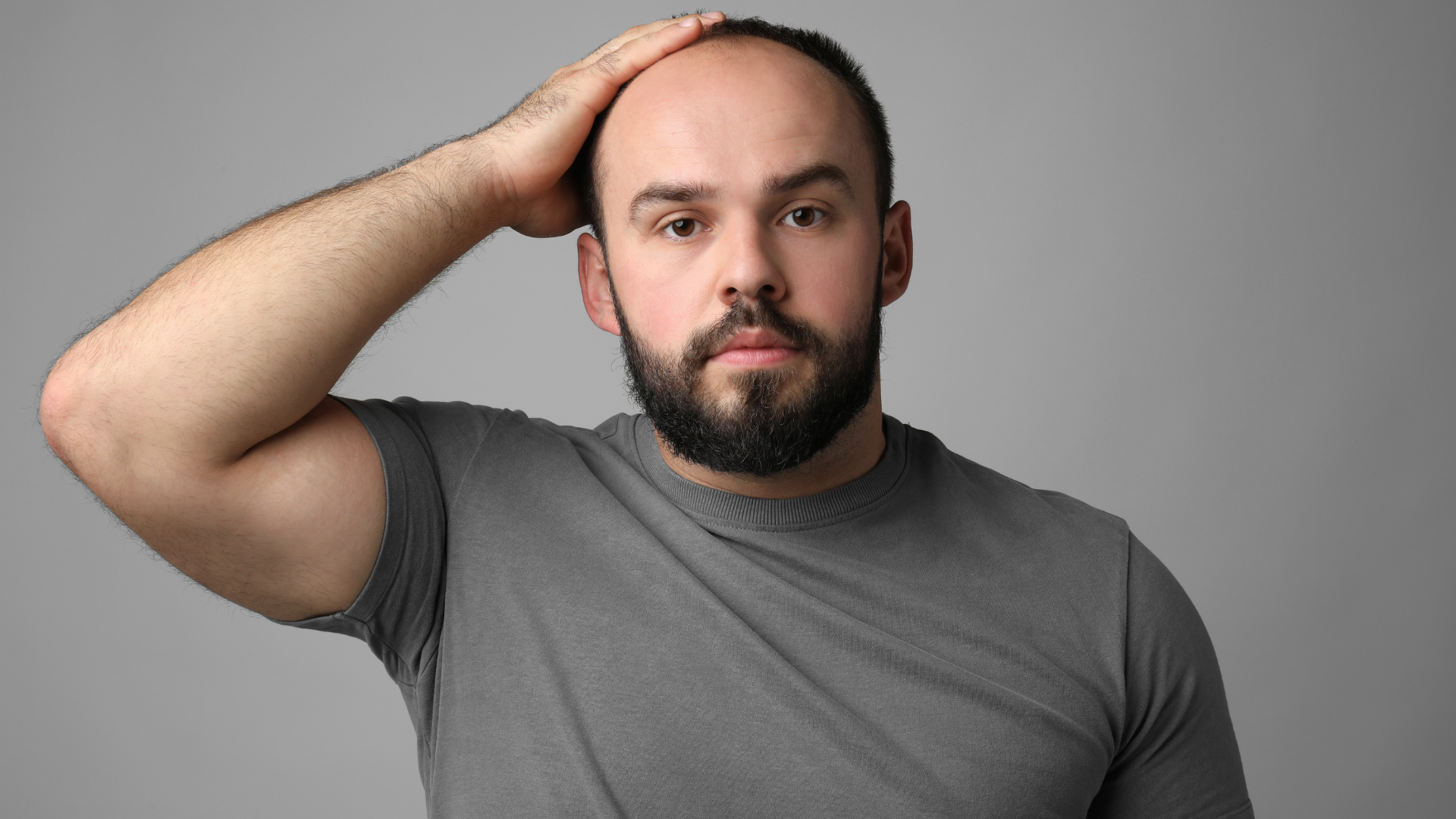 ¿Tener barba temprano aumenta el riesgo de quedarse calvo?