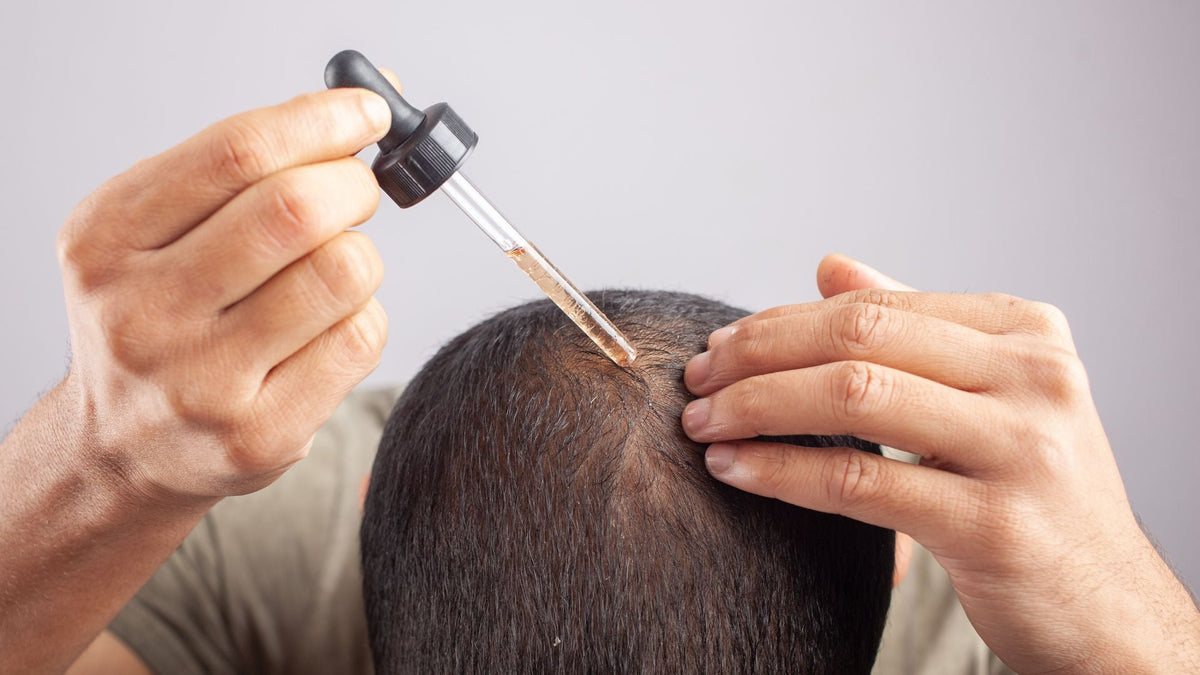 Alerta por minoxidil: el riesgo que debes conocer si tienes mascotas