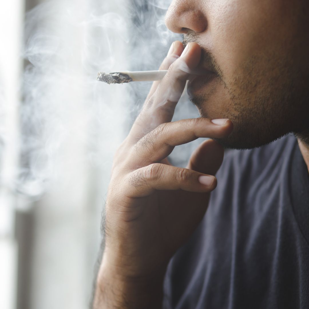 ¡El tabaco puede acelerar la calvicie!